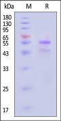 Human MMP-10 Protein, Tag Free (active enzyme)