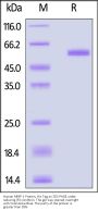 Human MMP-1 Protein, His Tag (active enzyme, MALS verified)