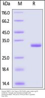 Human MMP-3 Protein, His Tag (active enzyme, MALS verified)