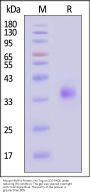 Mouse MMP-8 Protein, His Tag (active enzyme, MALS verified)