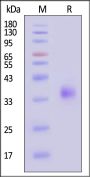 Mouse MMP-8 Protein, His Tag (active enzyme, MALS verified)