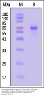 Cynomolgus MMP-9 Protein, His Tag (active enzyme)