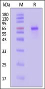 Cynomolgus MMP-9 Protein, His Tag (active enzyme)