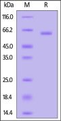Human MMP-9 Protein, His Tag (active enzyme) (MALS verified)