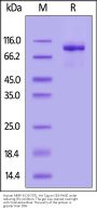 Human MMP-9 (20-707) Protein, His Tag (active enzyme, MALS verified)