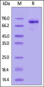 Human MMP-9 (20-707) Protein, His Tag (active enzyme, MALS verified)