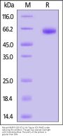 Mouse MMP-9 (20-471) Protein, His Tag (active enzyme, MALS verified)