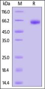 Mouse MMP-9 (20-471) Protein, His Tag (active enzyme, MALS verified)
