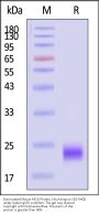 Biotinylated Mouse MOG Protein, His,Avitag™ (MALS verified)