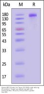 Human MRC2 Protein, His Tag (MALS verified)