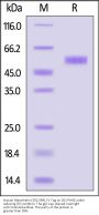 Human Mesothelin / MSLN (391-598) Protein, Fc Tag (MALS verified)