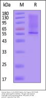 Human Mucin-1 / MUC-1 (24-380) Protein, His Tag (MALS verified)