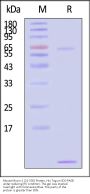 Mouse Mucin-1 / MUC-1 (21-535) Protein, His Tag (SPR verified)