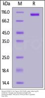 Mouse NCAM-1 / CD56 Protein, His Tag