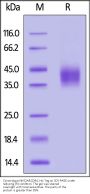 Cynomolgus NKG2A&CD94 Protein, His Tag