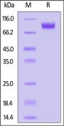 Mouse NKG2A&CD94 Protein, Fc Tag