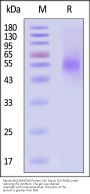 Mouse NKG2A&CD94 Protein, His Tag