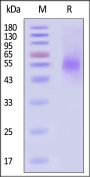 Mouse NKG2A&CD94 Protein, His Tag
