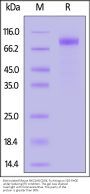 Biotinylated Mouse NKG2A&CD94 Protein, Fc,Avitag™