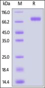 Rat NKG2A&CD94 Protein, Mouse IgG2a Fc Tag (MALS verified)