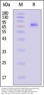 Influenza A [A/Darwin/9/2021 (H3N2)] Neuraminidase (NA) Protein, His Tag (MALS & SPR verified)