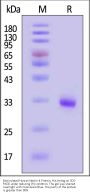 Biotinylated Human Nectin-4 Protein, His,Avitag™ (MALS verified)