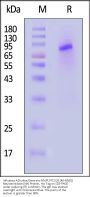 Influenza A [turkey/Germany-MV/R2472/2014(H5N8)] Neuraminidase (NA) Protein, His Tag (SPR verified)