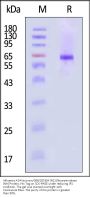 Influenza A [Wisconsin/588/2019(H1N1)] Neuraminidase (NA) Protein, His Tag