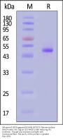 Influenza B (B/Singapore/WUH4618/2021) Neuraminidase (NA) Protein, His Tag