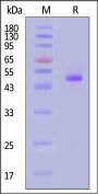 Influenza B (B/Singapore/WUH4618/2021) Neuraminidase (NA) Protein, His Tag