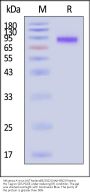 Influenza A virus (A/Thailand/8/2022) NA(H3N2) Protein, His Tag (SPR verified)
