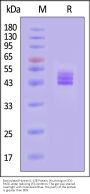Biotinylated Human IL-12B / NKSF2 / p40 Protein, His,Avitag™