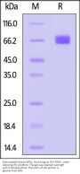 Biotinylated Human NPR1 / NPRA Protein, His,Avitag™ (MALS verified)