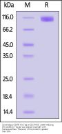 Cynomolgus OSMR beta Protein, His Tag (MALS verified)