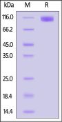 Cynomolgus OSMR beta Protein, His Tag (MALS verified)