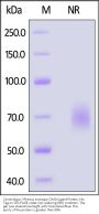 Cynomolgus / Rhesus macaque OX40 Ligand Protein, His Tag, active trimer (MALS verified)
