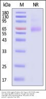 Human OX40 Ligand / TNFSF4 Protein, His Tag, active trimer (MALS verified)