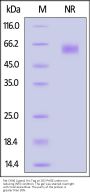 Rat OX40 Ligand / TNFSF4 Protein, His Tag (active trimer) (MALS verified)