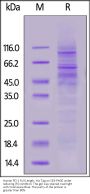 Human PD-1 / PDCD1 Full Length Protein, His Tag