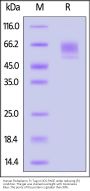 Human Podoplanin / PDPN Protein, Fc Tag (MALS verified)