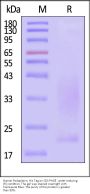 Human Podoplanin / PDPN Protein, His Tag (SPR verified)