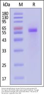 Human parainfluenza viruses Pre-fusion glycoprotein F0, His Tag (MALS verified)