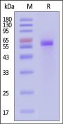 Human parainfluenza viruses Pre-fusion glycoprotein F0, His Tag (MALS verified)
