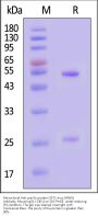 Monoclonal Anti-pre-Gc protein (SFTS virus (HN6)) Antibody, Mouse IgG1 (13E1)