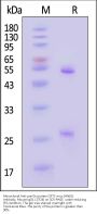 Monoclonal Anti-pre-Gc protein (SFTS virus (HN6)) Antibody, Mouse IgG1 (17D4)