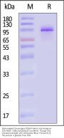 Biotinylated Cynomolgus PSMA / FOLH1 Protein, His,Avitag™ (MALS verified)