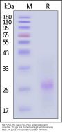 Rat PVRIG Protein, His Tag (MALS verified)
