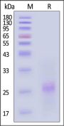 Rat PVRIG Protein, His Tag (MALS verified)