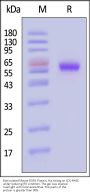Biotinylated Mouse ROR1 Protein, His,Avitag™ (MALS verified)