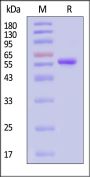 Mouse ROR2 / NTRKR2 Protein, His Tag (MALS verified)